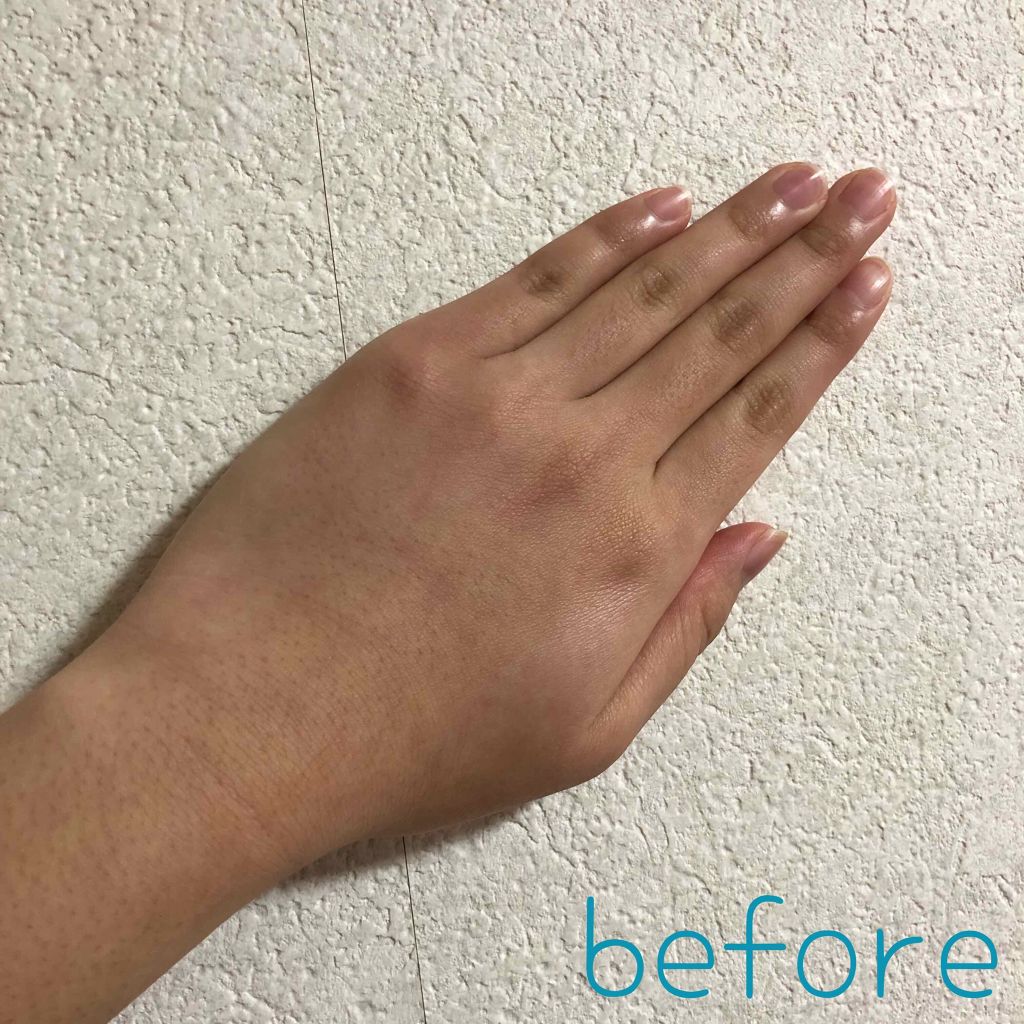 エバレッシュホワイトEX(医薬品)/エバレッシュ/その他を使ったクチコミ(2枚目)