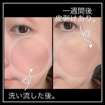 ダーマスキンピーリング/BQCELL/その他キットセットを使ったクチコミ(4枚目)