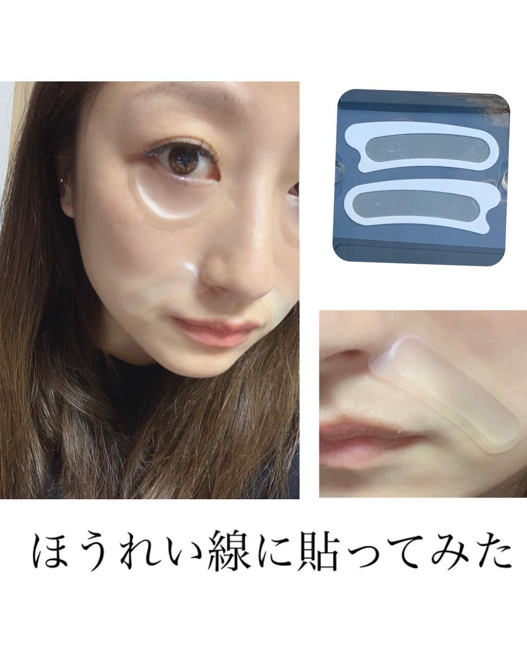 はなゆい☆ on LIPS 「..ずーっと気になってたMediLift使ってみました🤭💕....」(5枚目)