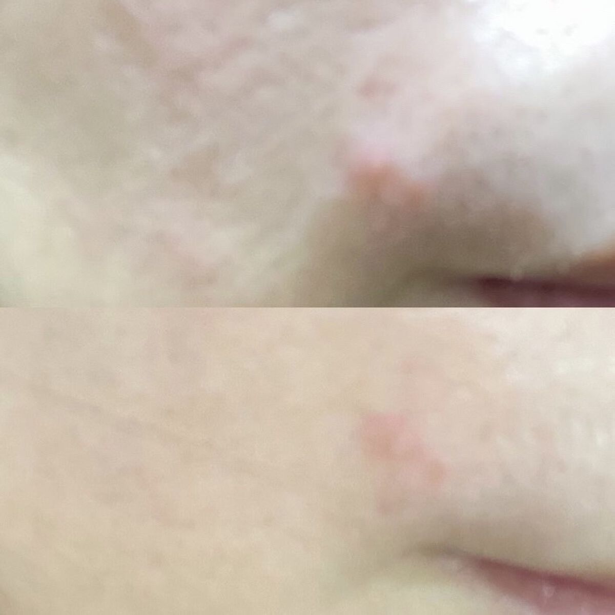 スリープアンドピールマスクパック/MIDAMSU/洗い流すパック・マスクを使ったクチコミ（2枚目）