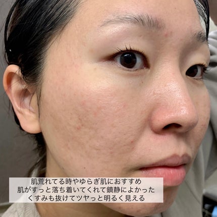 モデリングカップパック ビタミン/LINDSAY/洗い流すパック・マスクを使ったクチコミ(9枚目)