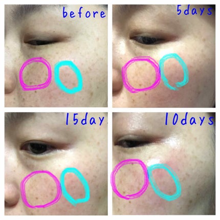 ホワイト 薬用ドットゼロ/リッツ/美容液を使ったクチコミ(2枚目)