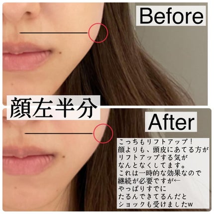 スカルプリフト アクティブ/mysé(ミーゼ)/美顔器・マッサージを使ったクチコミ(6枚目)