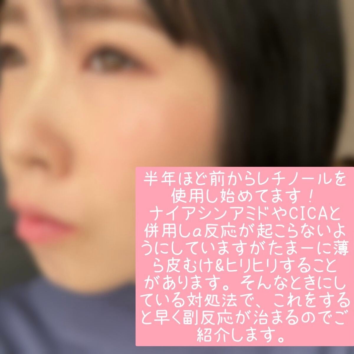 RMK Wトリートメントオイル/RMK/ブースター・導入液を使ったクチコミ(2枚目)