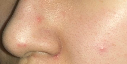 ノーモアブラックヘッド(ノーズピーリング)/One-day's you/スクラブ・ゴマージュを使ったクチコミ(4枚目)