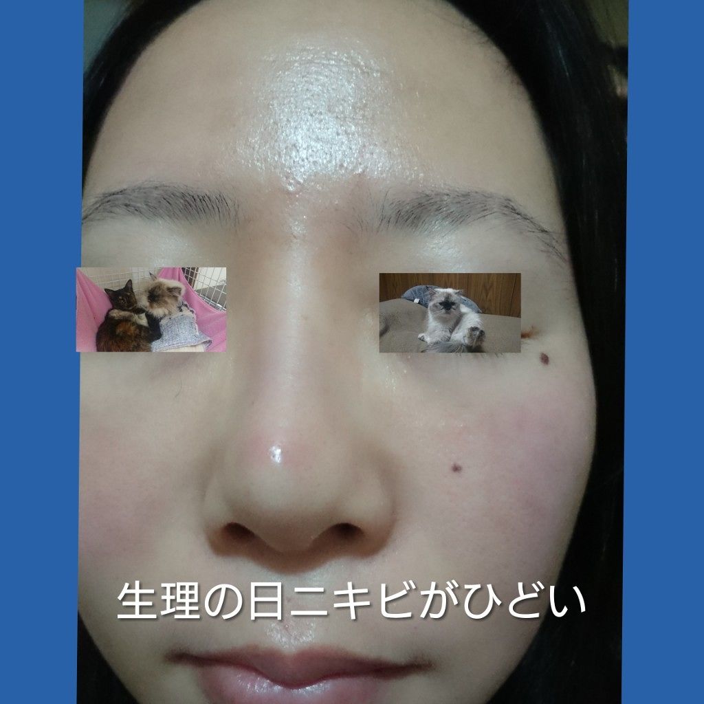 菊正宗 日本酒の化粧水 高保湿/菊正宗/化粧水を使ったクチコミ(3枚目)