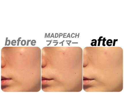 マッドピーチ スタイルフィットファンデーション/MAD PEACH/リキッドファンデーションを使ったクチコミ(2枚目)