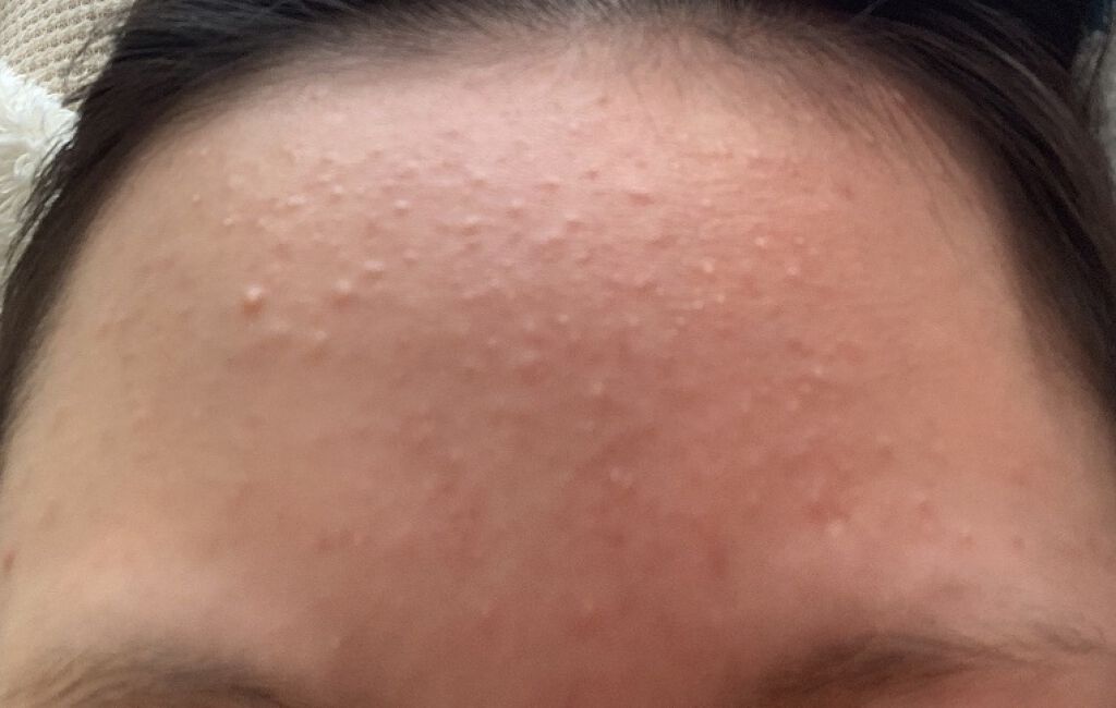 ハトムギ化粧水(ナチュリエ スキンコンディショナー R )/ナチュリエ/化粧水を使ったクチコミ（1枚目）