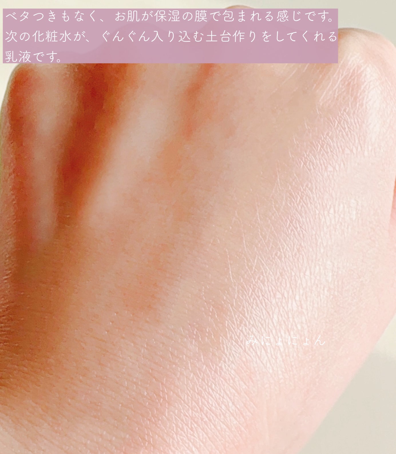 エクシア ラディアンスリニュー エクストラリッチミルク/ALBION/乳液を使ったクチコミ(4枚目)