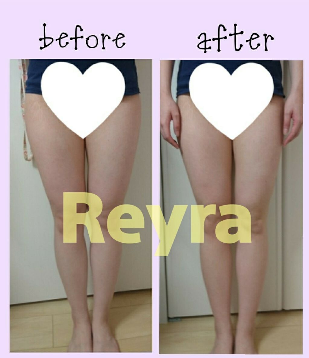 寝ながらメディキュット ロング/メディキュット/着圧ソックス・レギンスを使ったクチコミ（1枚目）