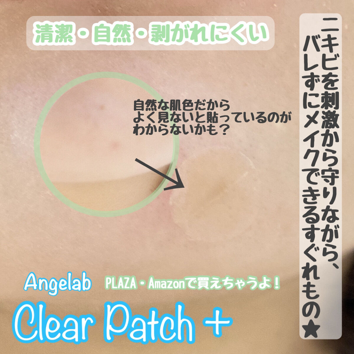 クリアパッチ/Angelab/にきびパッチを使ったクチコミ（3枚目）