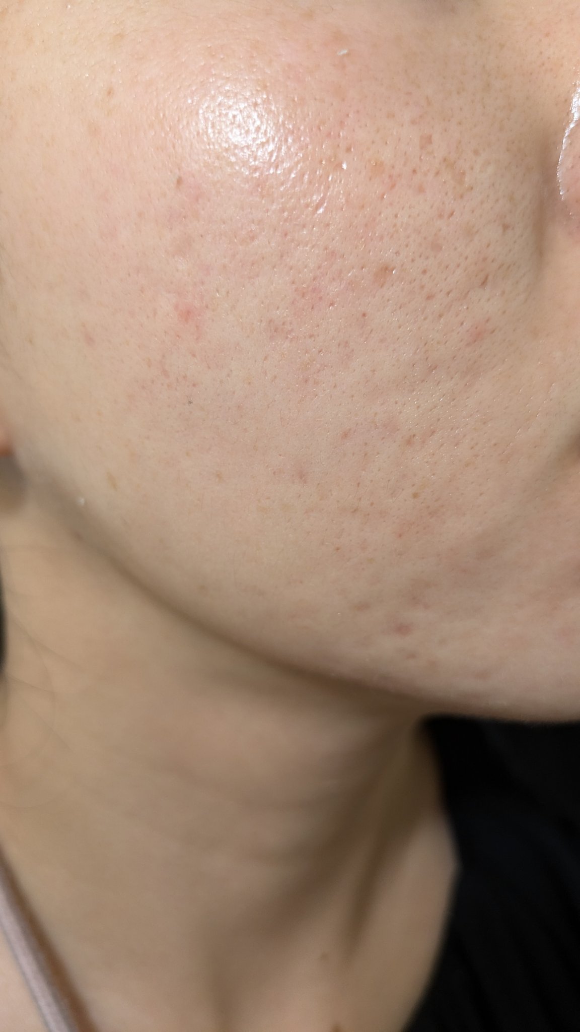 A2+NAG2ソリューション/The Ordinary/美容液を使ったクチコミ（1枚目）