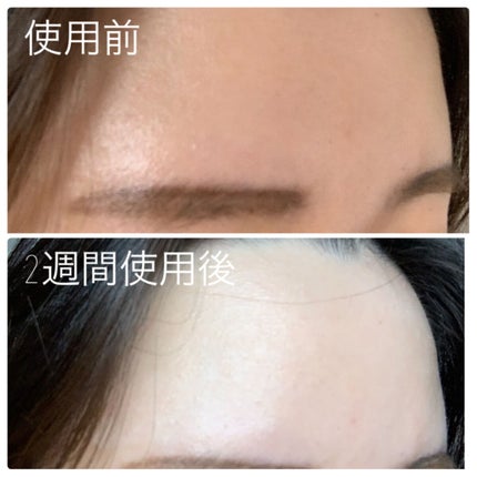 バイオ コンディショニング エッセンス/IOPE/ブースター・導入液を使ったクチコミ(3枚目)