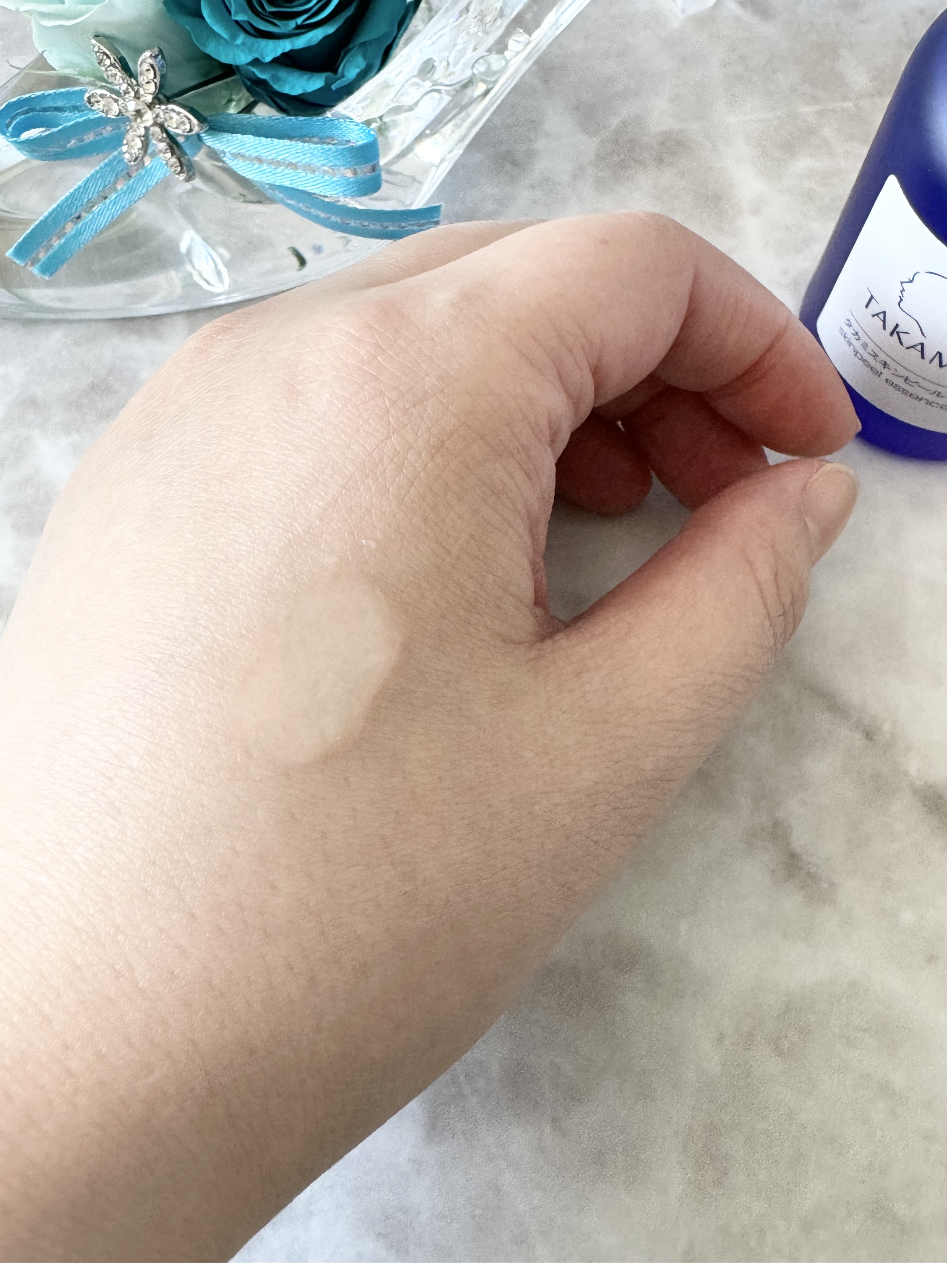 タカミスキンピール/タカミ/ブースター・導入液を使ったクチコミ（3枚目）