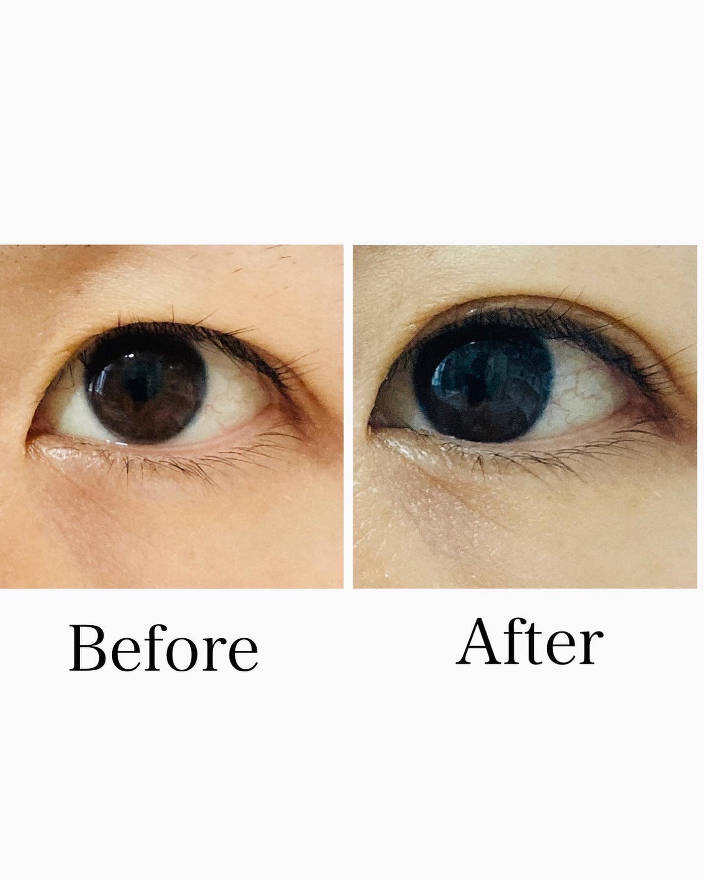 ETERNITY LINE α+/Girl's Maker/二重まぶた用アイテムを使ったクチコミ(2枚目)