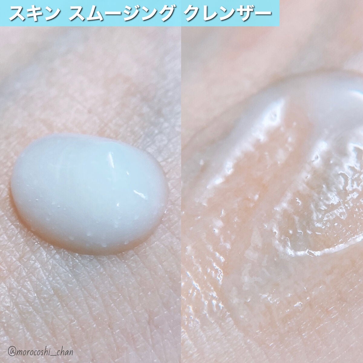 薬用3ステップセット30日サイズ/プロアクティブ/トライアルキットを使ったクチコミ(2枚目)