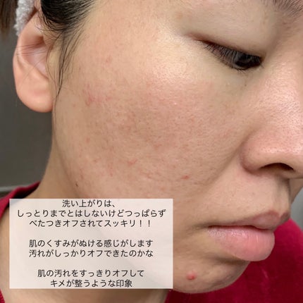 ドクダミポアディープクレンジングフォーム/Anua/洗顔フォームを使ったクチコミ(6枚目)