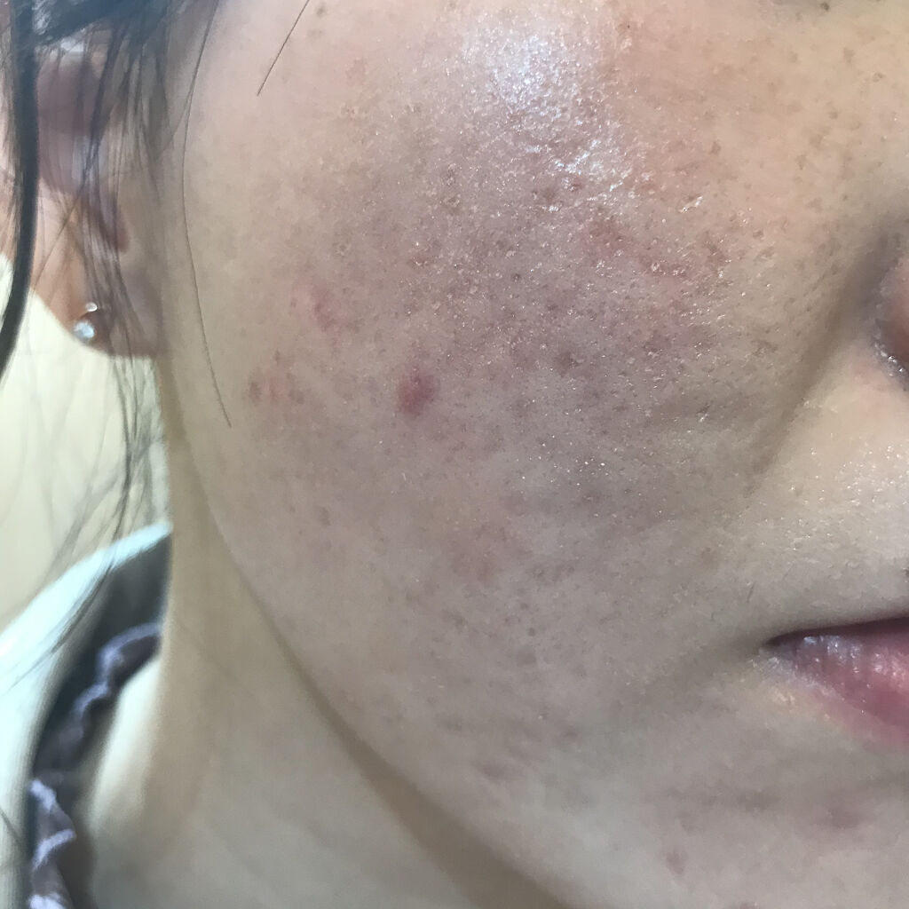 ゼン ウェア フルイド C23/DECORTÉ/リキッドファンデーションを使ったクチコミ（3枚目）