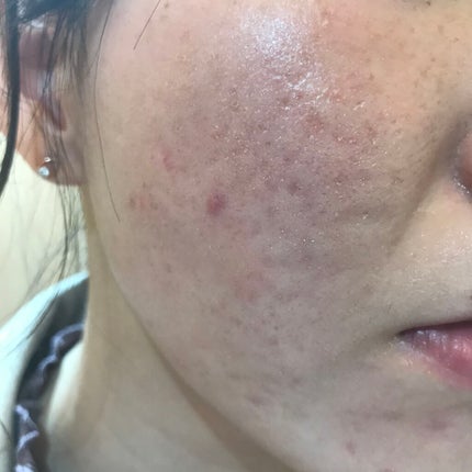 ゼン ウェア フルイド/DECORTÉ/リキッドファンデーションを使ったクチコミ(3枚目)