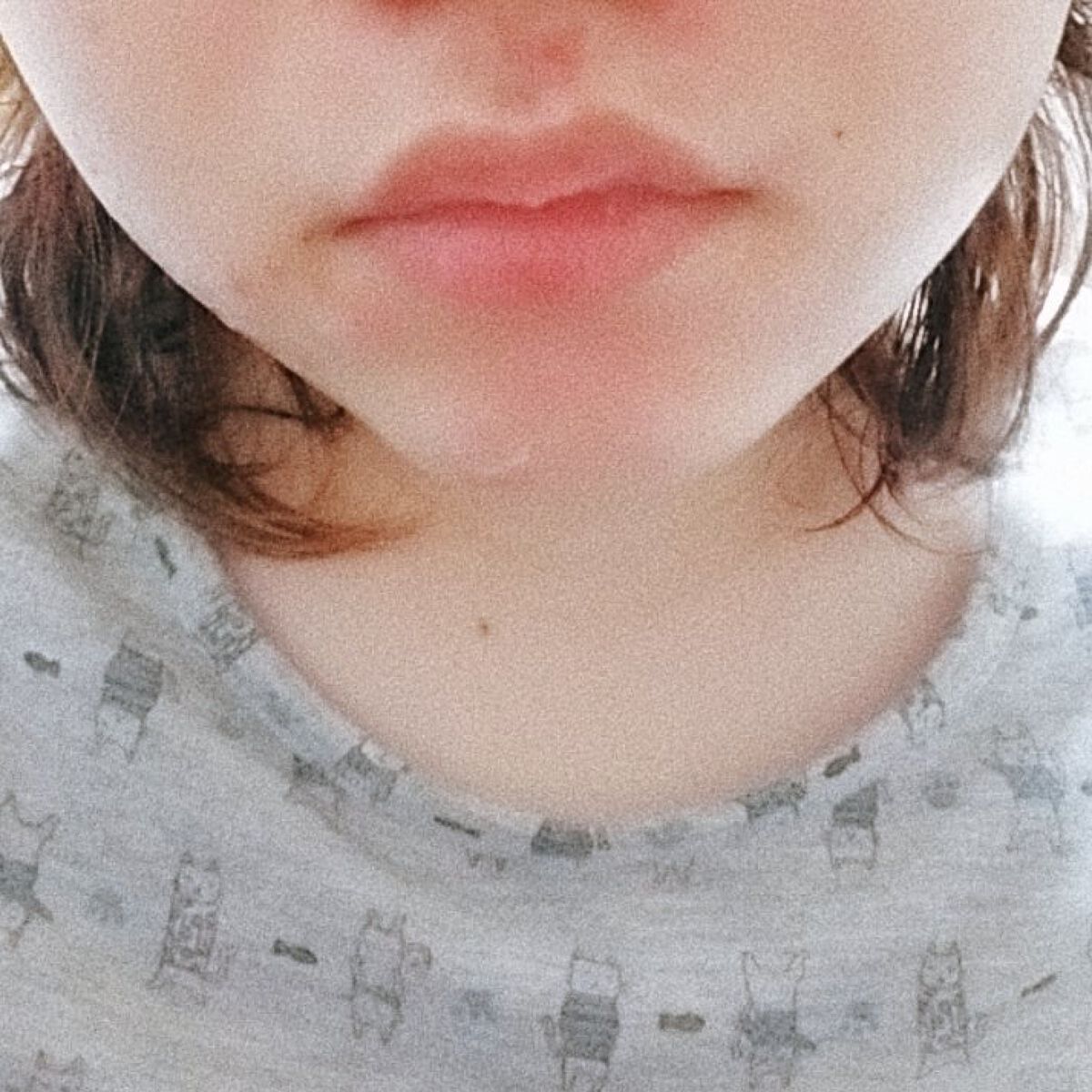 プロCICA クリアスポットパッチ/VT/その他スキンケアを使ったクチコミ（3枚目）