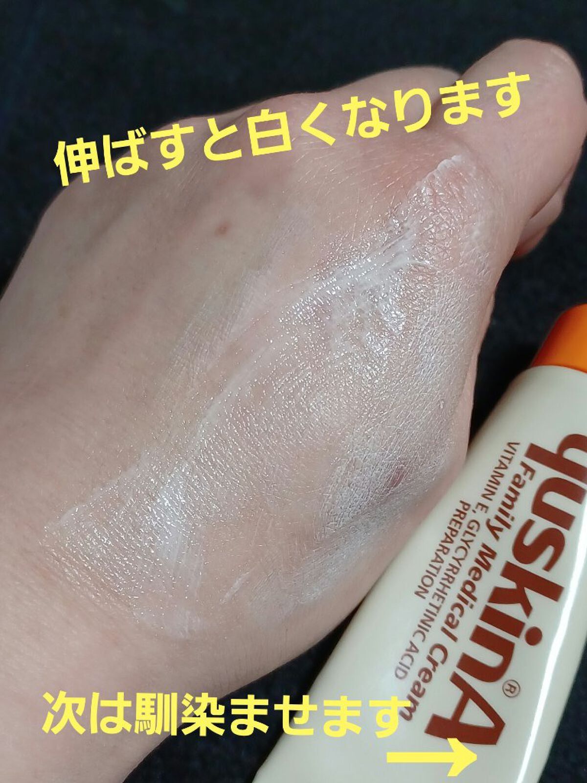 ユースキン/ユースキン/ボディクリームを使ったクチコミ(2枚目)