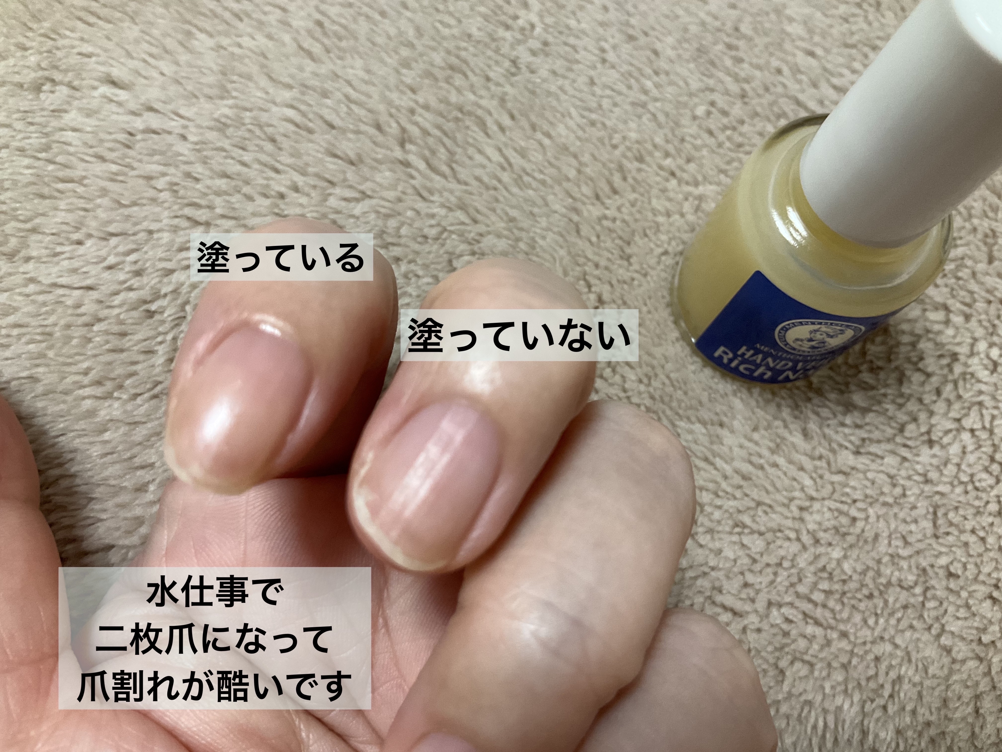 kurokamiスカルプ/haru/市販シャンプーを使ったクチコミ（2枚目）