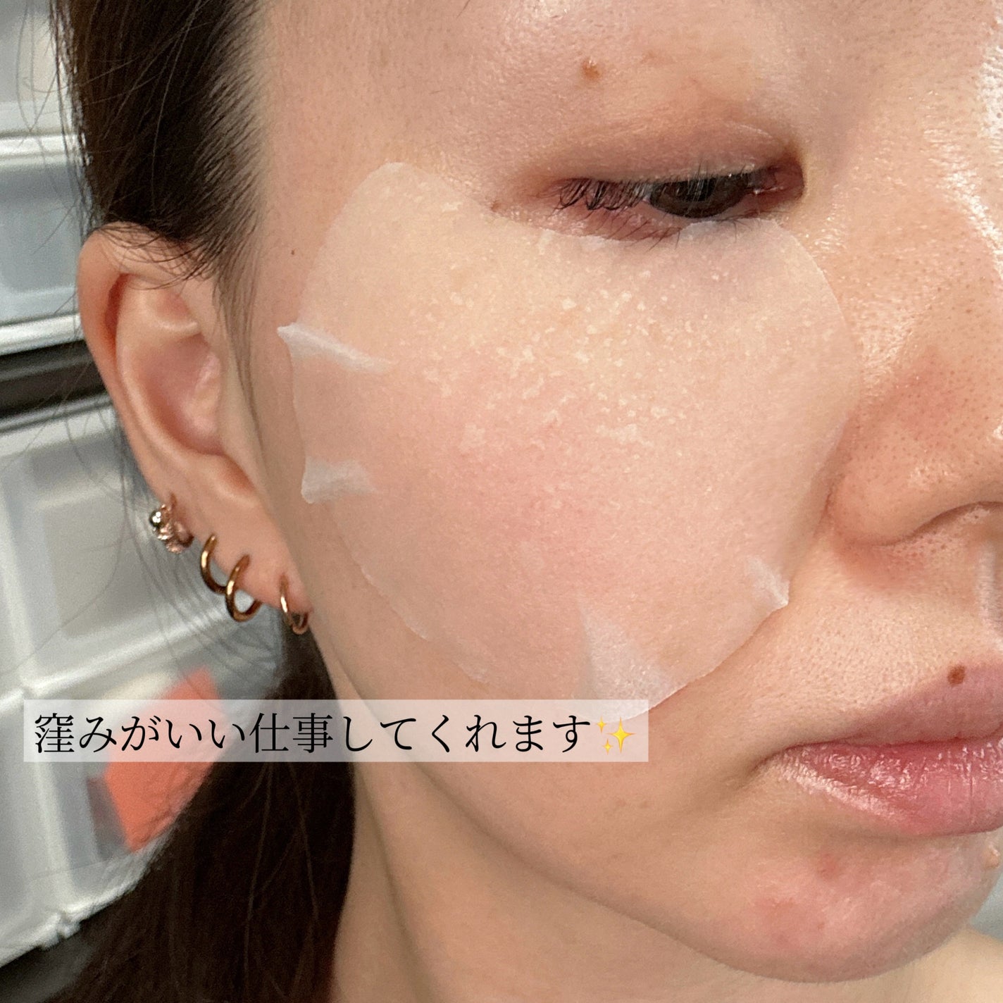 センテラ クイックカーミングパッド/SKIN1004/トナーパッドを使ったクチコミ(4枚目)