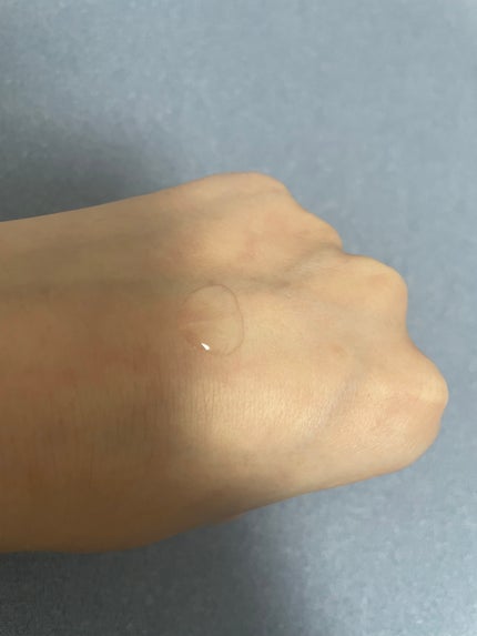 薬用 RJ地肌ケア エッセンス /アピセラピーコスメティクス/頭皮ローションを使ったクチコミ(5枚目)