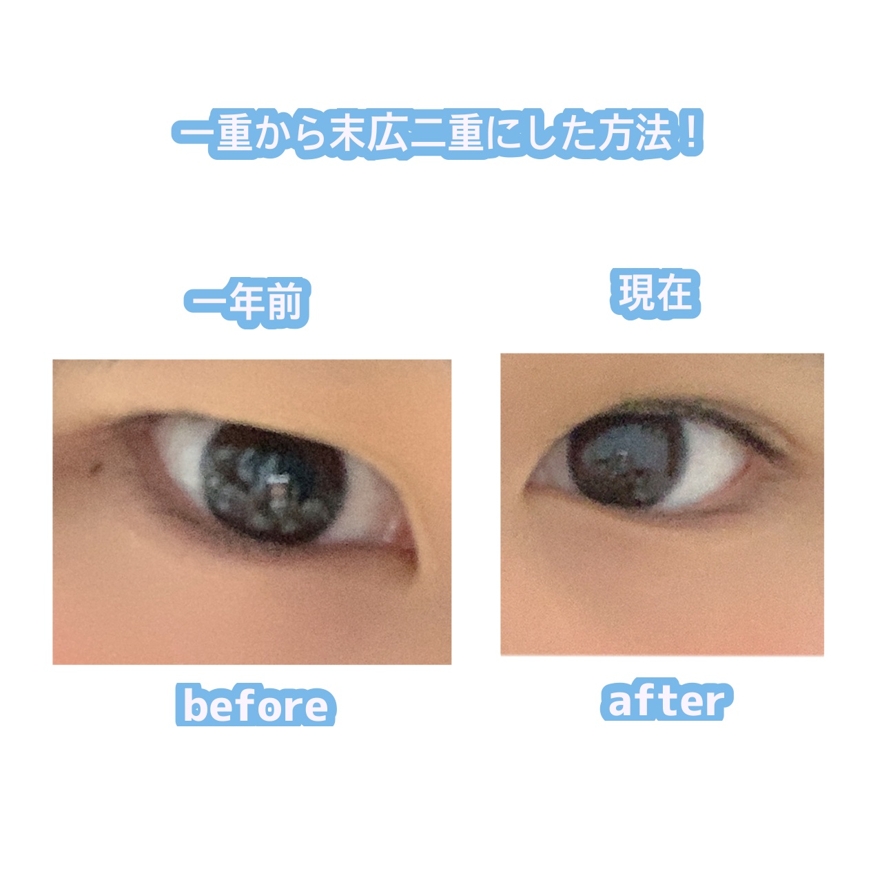 のび〜る アイテープ 両面テープタイプ/DAISO/二重まぶた用アイテムを使ったクチコミ（1枚目）