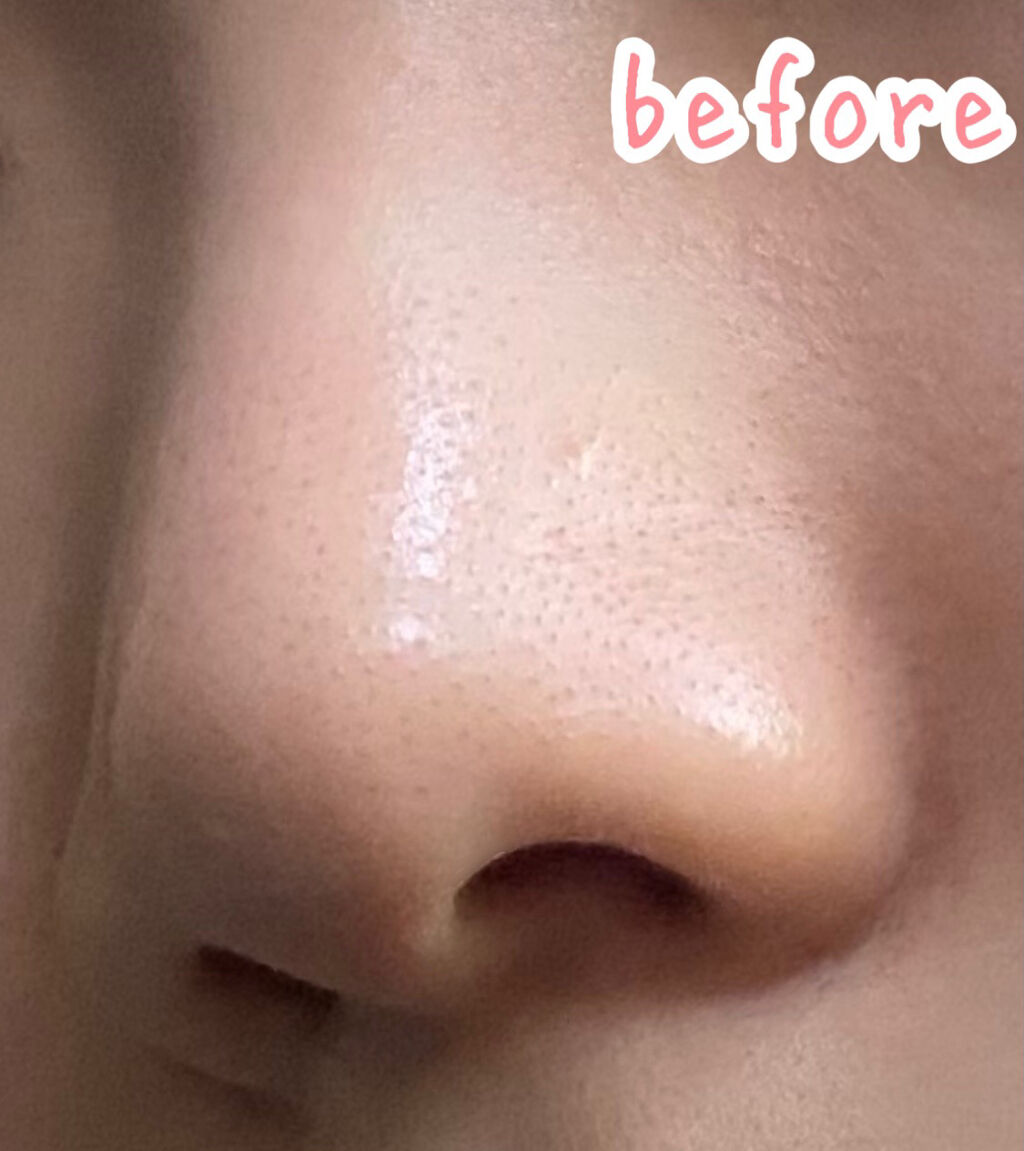 薬用 しみ 集中対策 美容液/メラノCC/美容液を使ったクチコミ（3枚目）