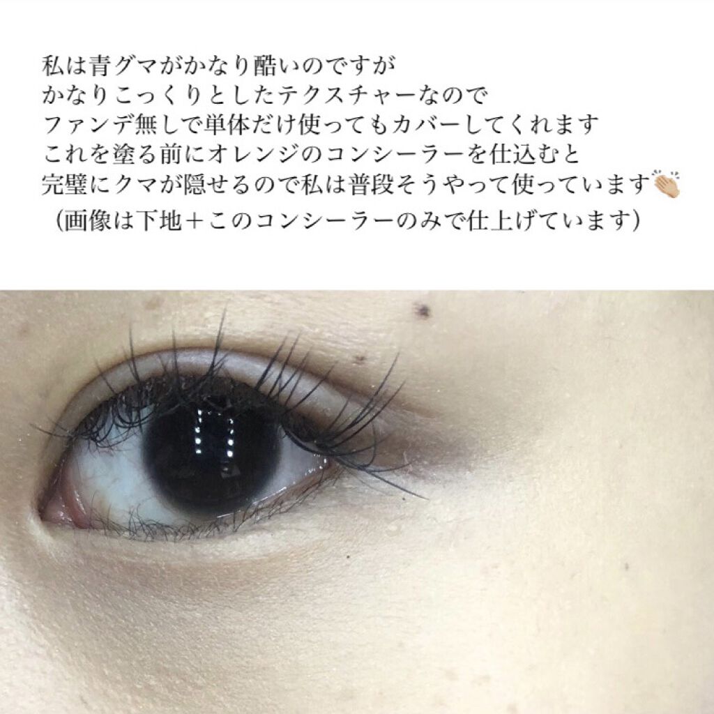 【旧】ディオールスキン フォーエヴァー スキン コレクト コンシーラー/Dior/リキッドコンシーラーを使ったクチコミ（3枚目）