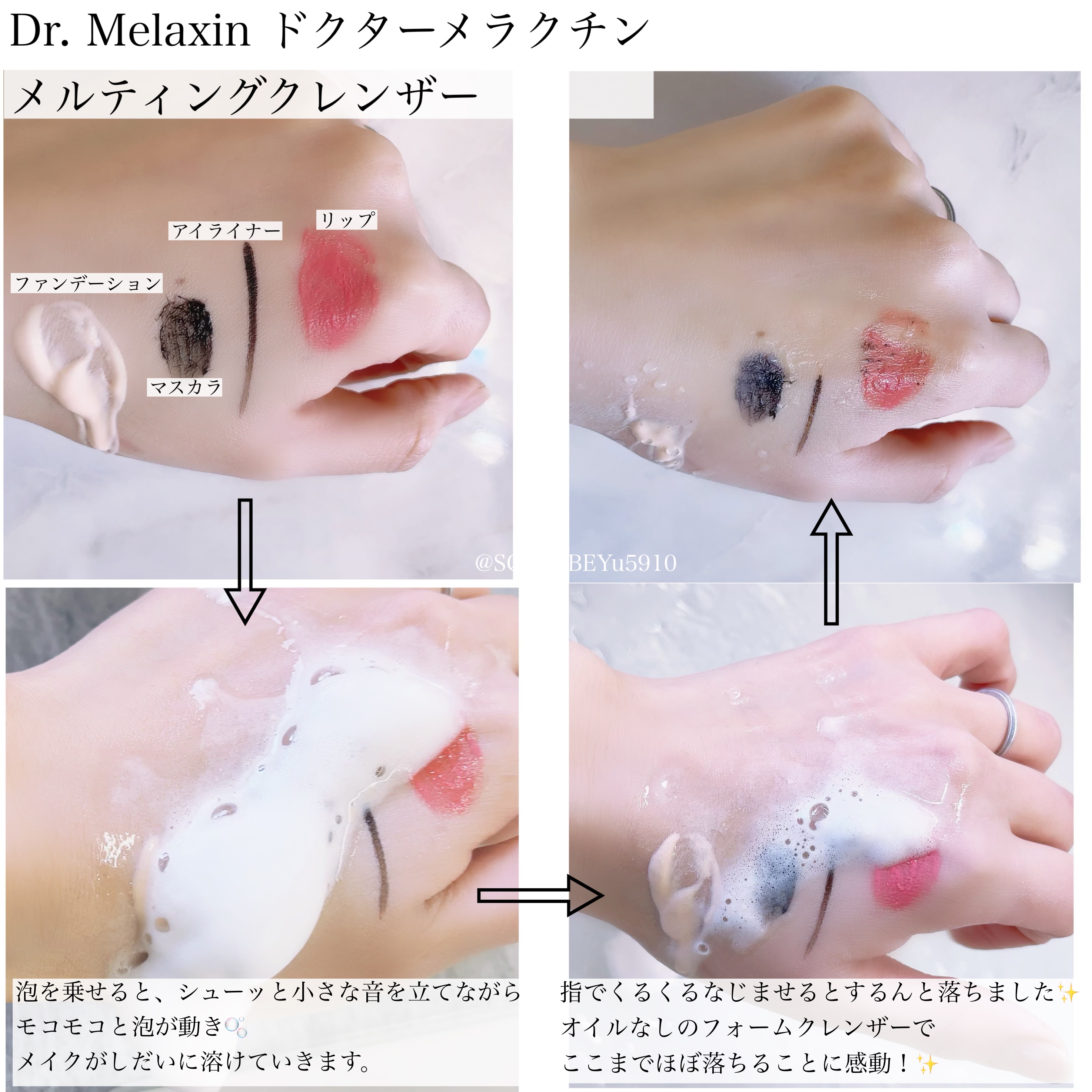 メルティングクレンザー/Dr.Melaxin/クレンジングウォーターを使ったクチコミ（2枚目）