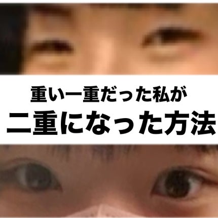 アイビューティー フィクサー WP/アストレア ヴィルゴ/二重まぶた用アイテムを使ったクチコミ(1枚目)