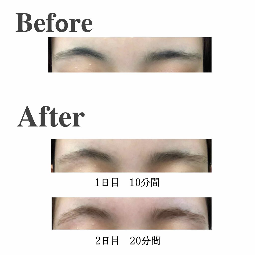 脱色クリーム 敏感肌用/エピラット/ムダ毛ケアを使ったクチコミ（2枚目）