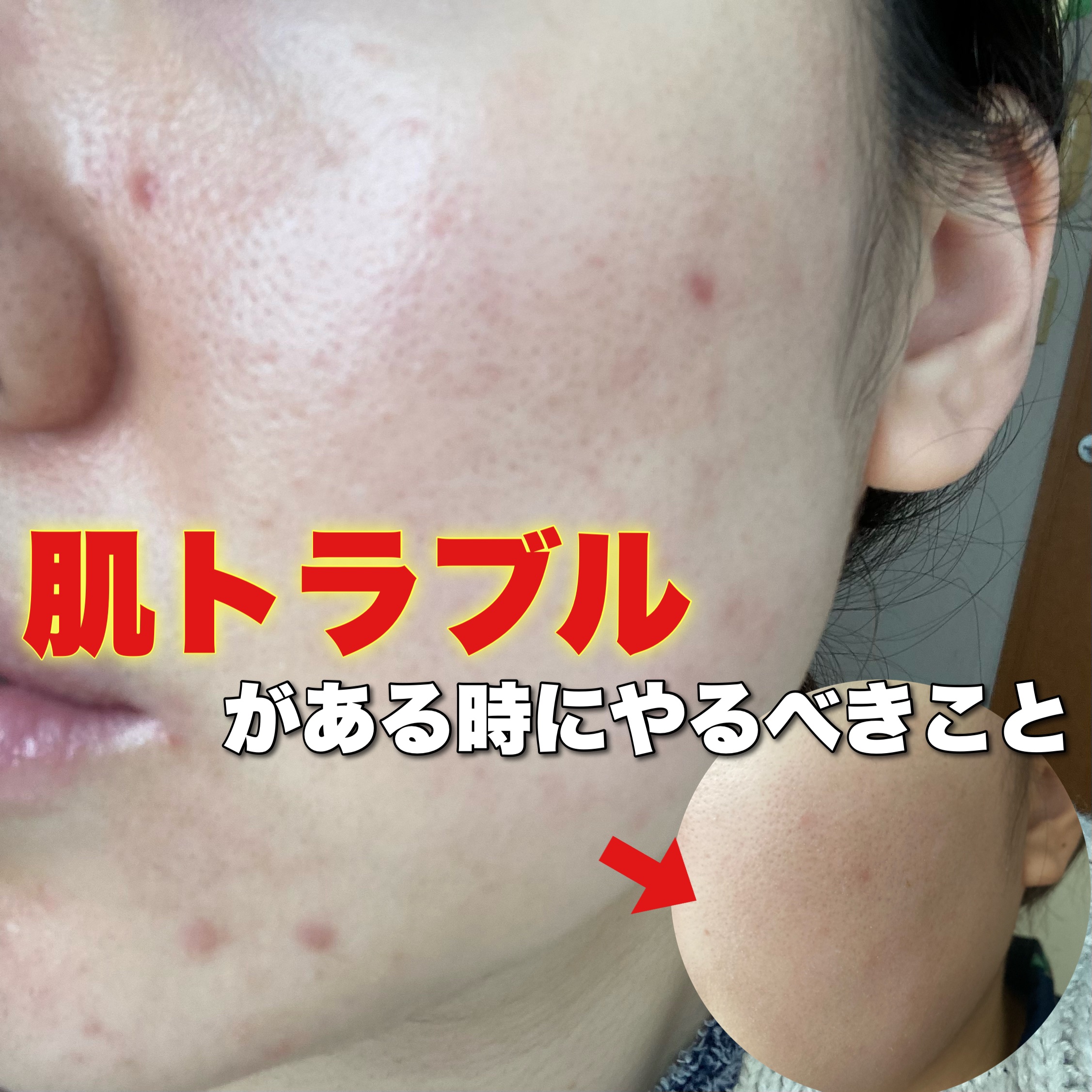 潤浸保湿 乳液/キュレル/乳液を使ったクチコミ（1枚目）