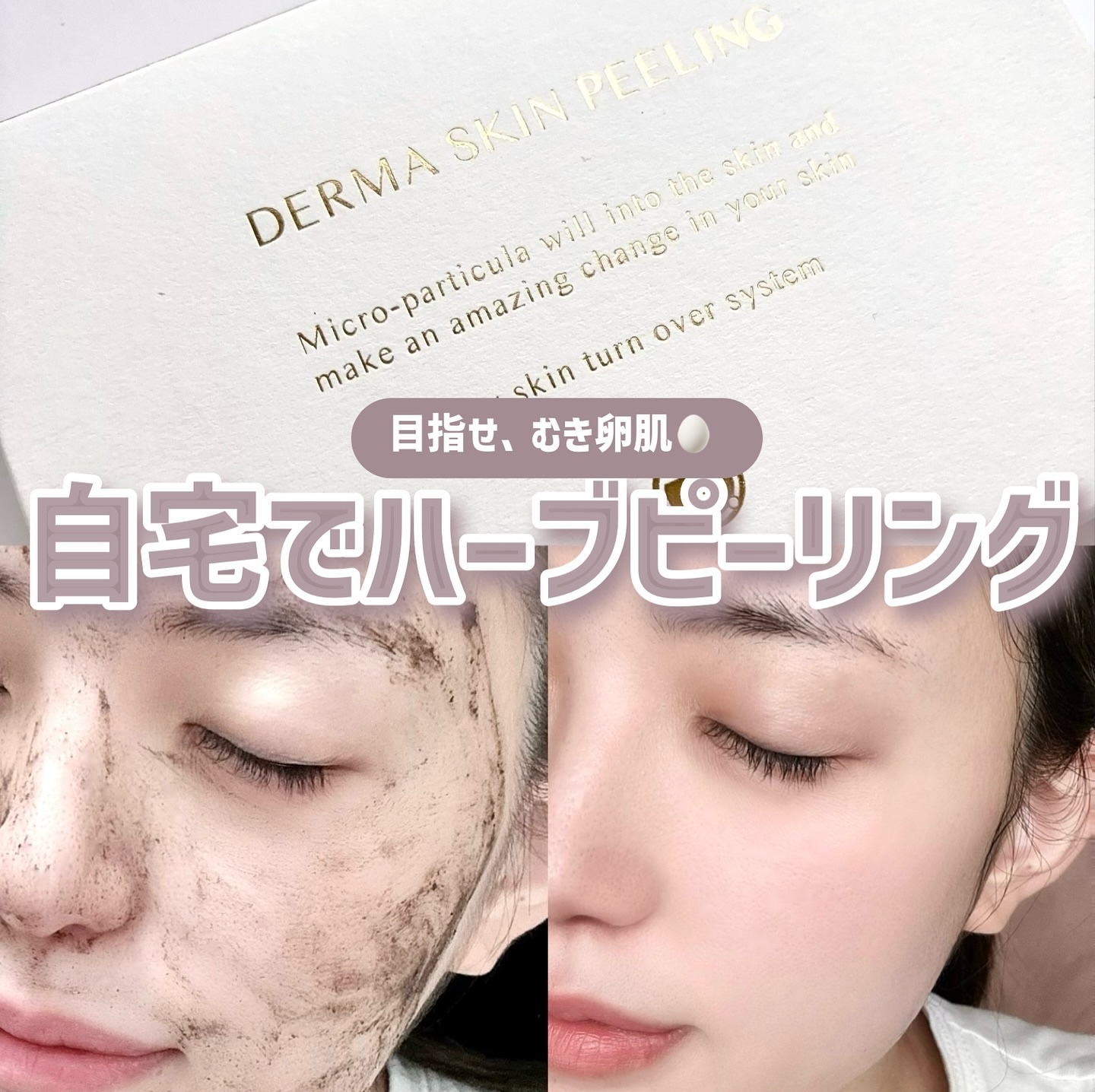 ダーマスキンピーリング/BQCELL/その他キットセットを使ったクチコミ（1枚目）