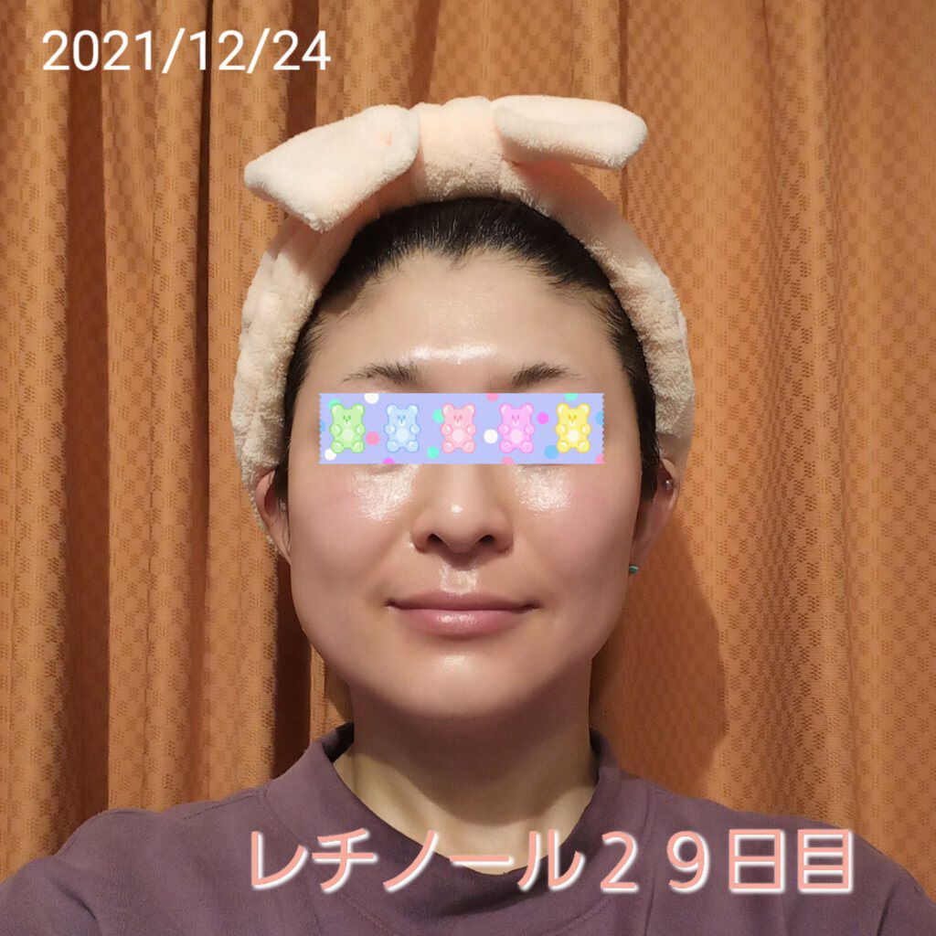 モイスチャーバーム ジャー/キュレル/フェイスクリームを使ったクチコミ（1枚目）