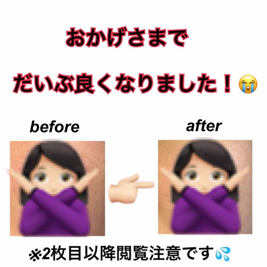 お米のマスク/毛穴撫子/シートマスク・パックを使ったクチコミ（1枚目）