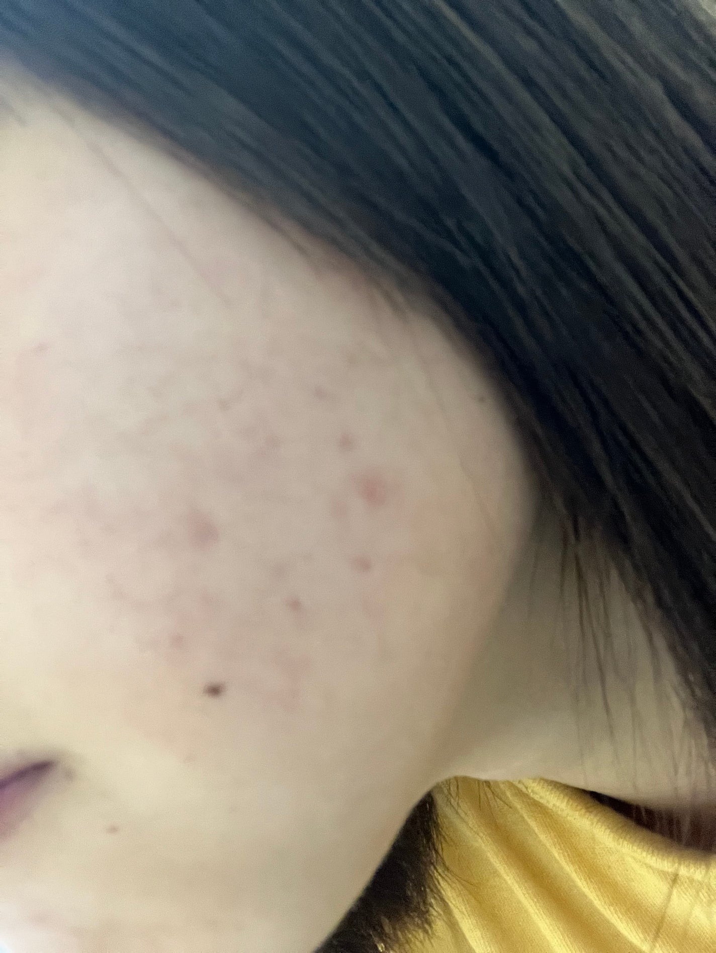 薬用毛穴すっきり粒つぶ洗顔/メンソレータム アクネス/洗顔フォームを使ったクチコミ(4枚目)