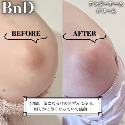 BnDアンダーアームクリーム(ボディクリーム)/BnD/デリケートゾーンケアを使ったクチコミ(5枚目)
