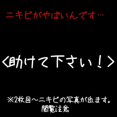 しゅがー on LIPS 「助けてください！！！写真はわかりやすい様に無加工です写真見たら..」（1枚目）