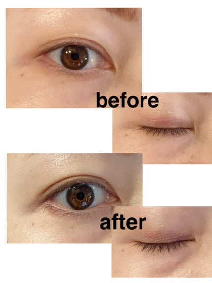 まぶたテープ/SHEIN/二重まぶた用アイテムを使ったクチコミ(4枚目)