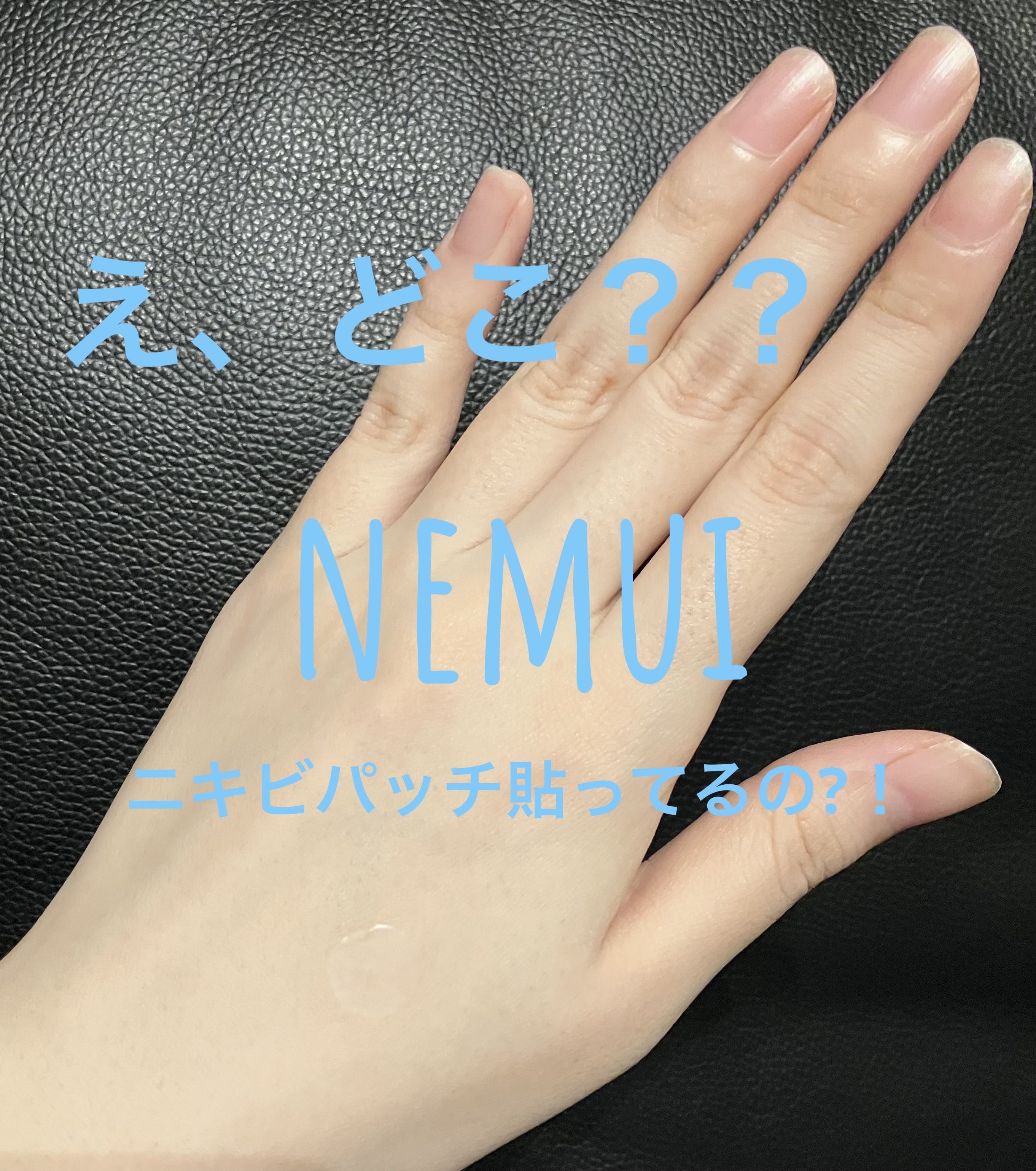 極薄透明パッチ nikipa!/金冠堂/にきびパッチを使ったクチコミ（1枚目）