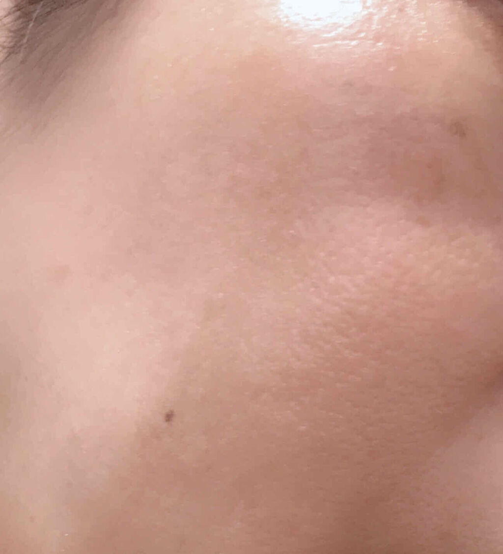 【旧】ディオールスキン フォーエヴァー スキン コレクト コンシーラー/Dior/リキッドコンシーラーを使ったクチコミ（2枚目）