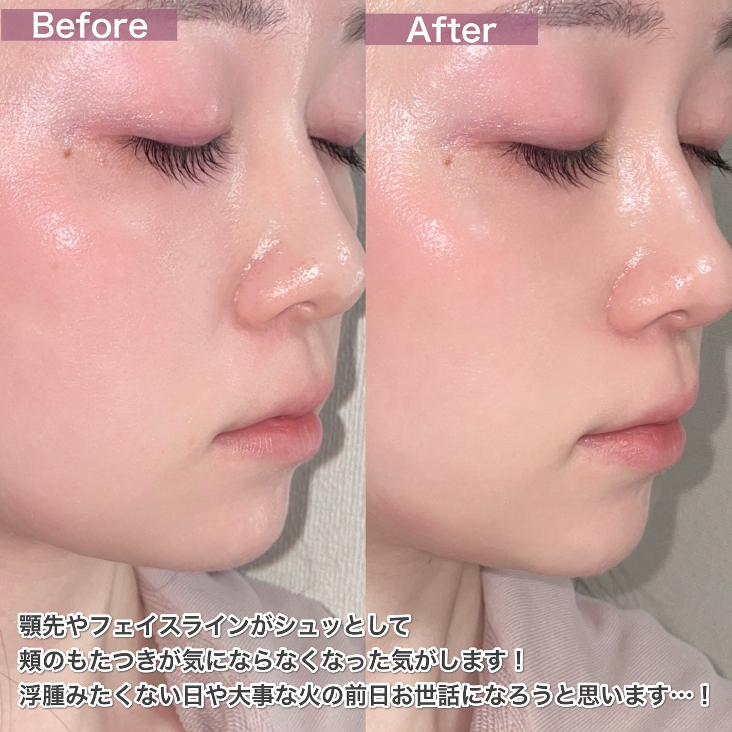 9番 NMNバイオリフト濃縮美容液/numbuzin/美容液を使ったクチコミ(5枚目)