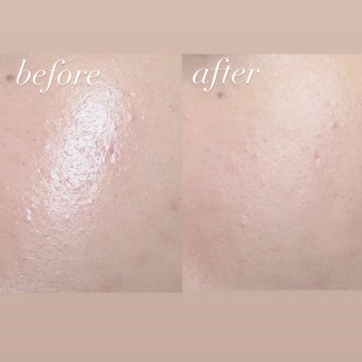 プードルコンパクトエサンシエルｎ エレガントスリム（5g）/クレ・ド・ポー ボーテ/プレストパウダーを使ったクチコミ（2枚目）