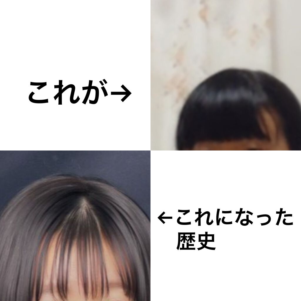 亜鉛 30日分 栄養機能食品 亜鉛 Dhcの口コミ 前髪を薄くする方法 なのかはわかんないけど 笑笑 By ルカ 乾燥肌 10代後半 Lips