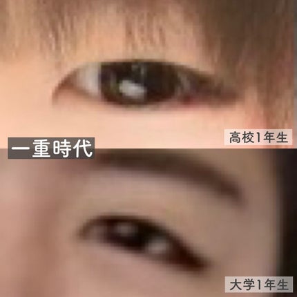 ãªãªã·ã ã¢ã€ãªããã¹ãã³ãã£ã«ã 		/D-UP/äºéãŸã¶ãçšã¢ã€ãã ã䜿ã£ãã¯ãã³ãïŒ3æç®ïŒ