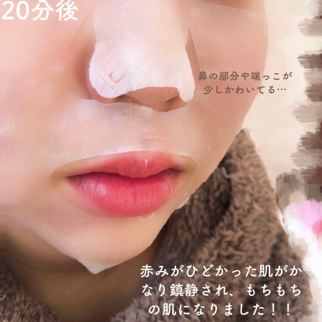ティーツリーケアソリューション アンプルマスクJEX/MEDIHEAL/シートマスク・パックを使ったクチコミ(4枚目)