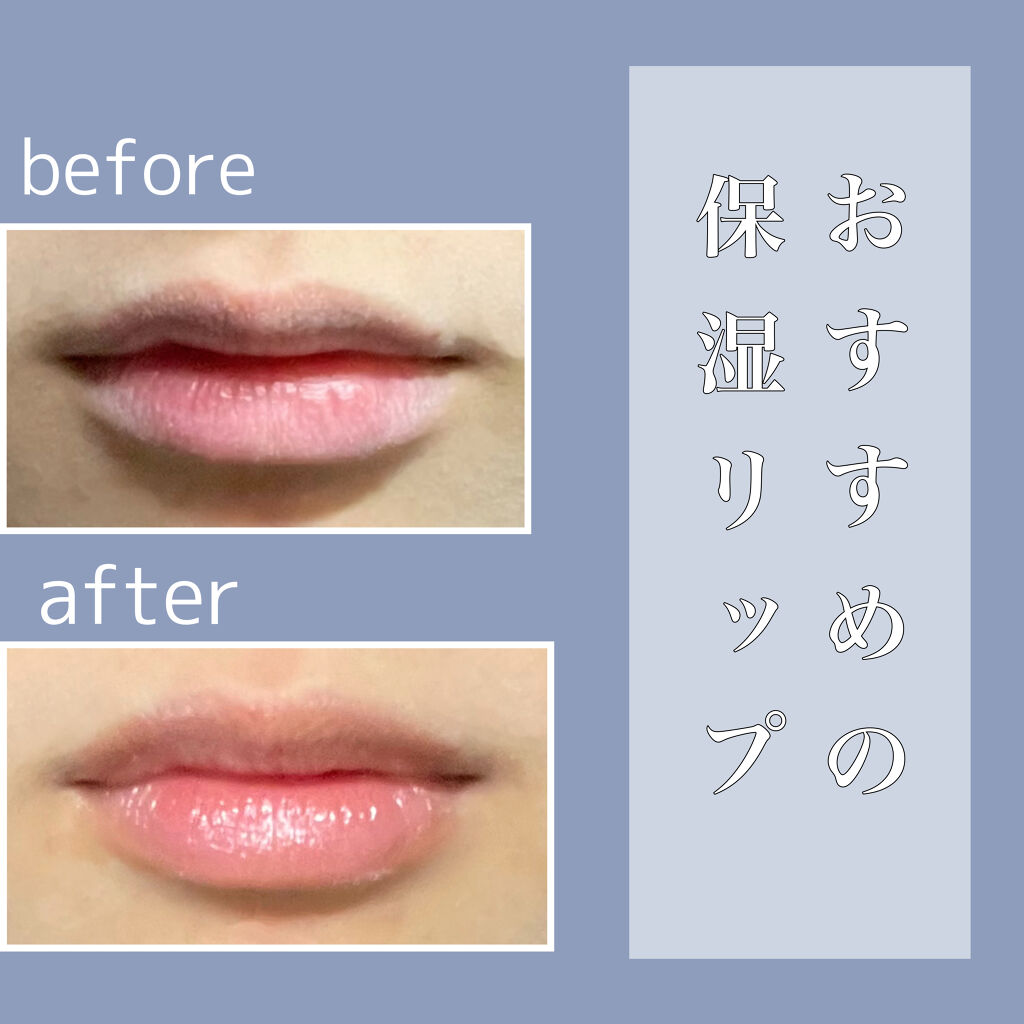 メルティクリームリップ/メンソレータム/リップクリームを使ったクチコミ（1枚目）